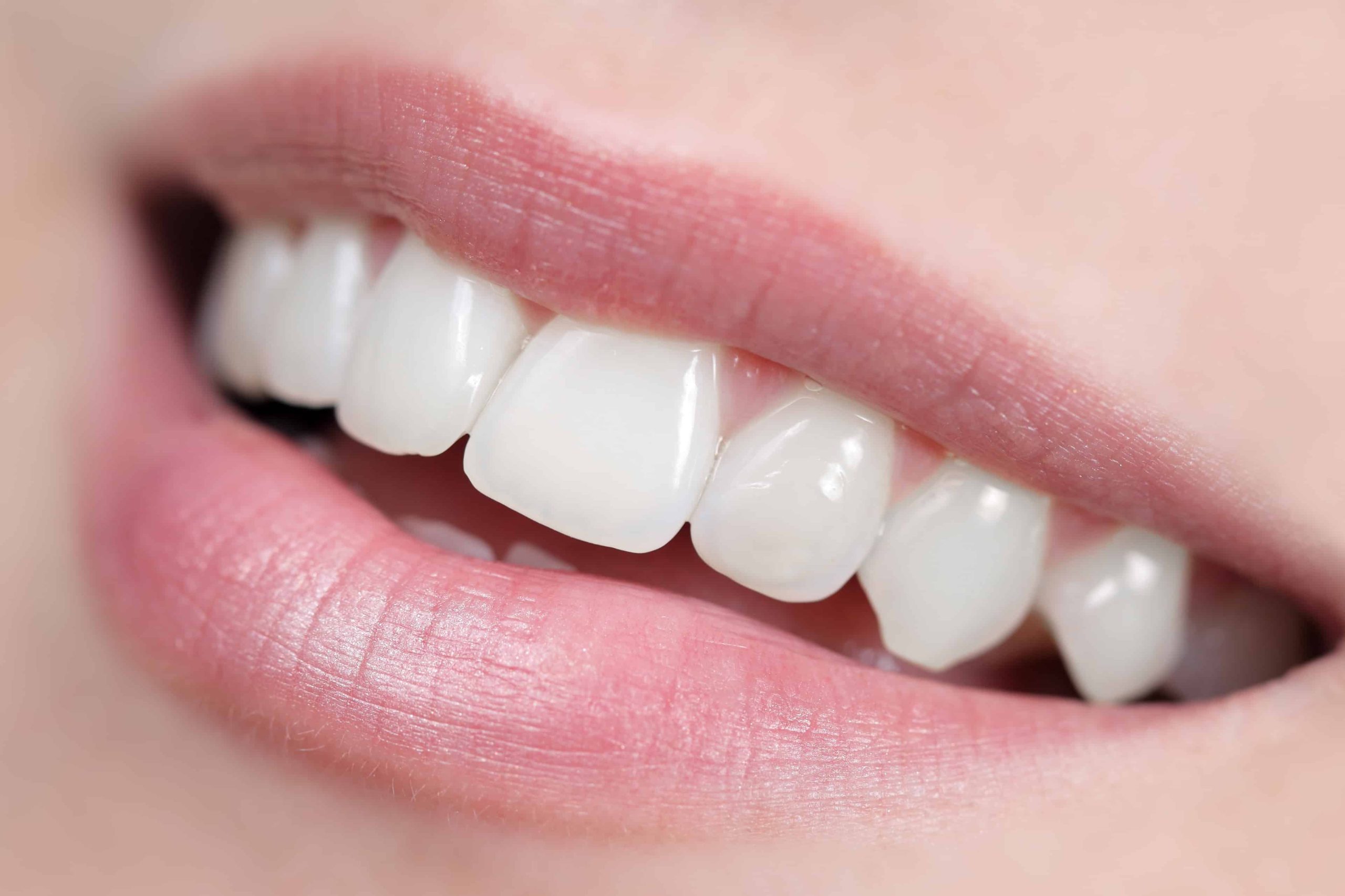 Achieving a Perfect Smile with Invisalign in Bromley: What to Expect